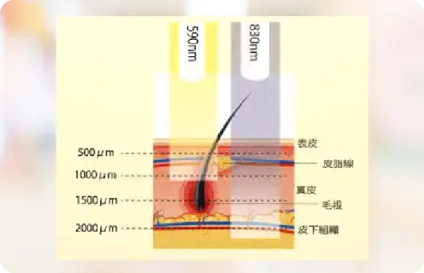 LED_細胞を活性化