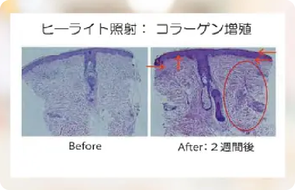 LED_安全性が高い