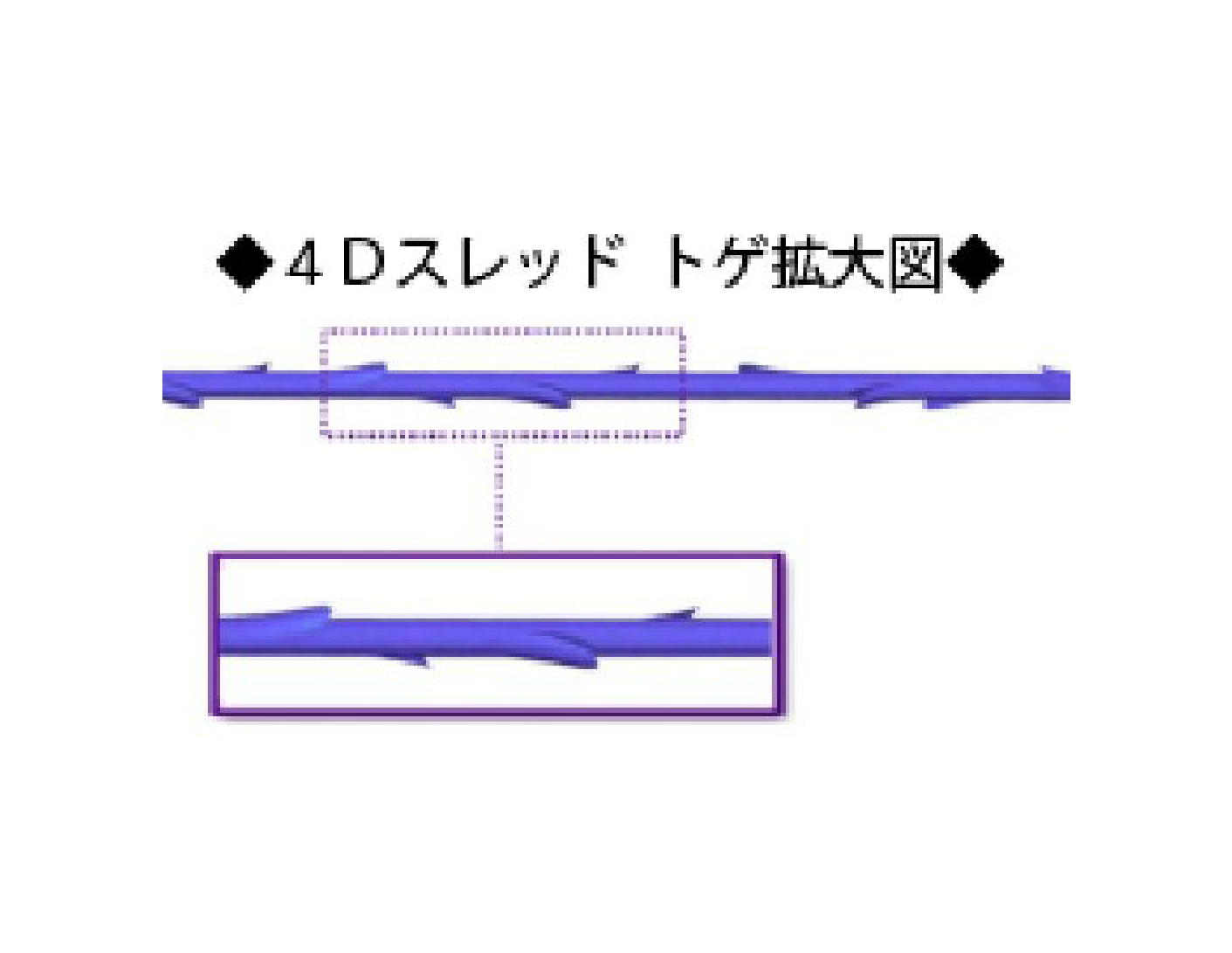 4D糸リフト